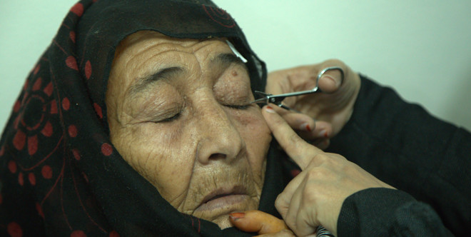 Yemen Cataract Surgery